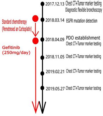 Organoid drug screening report for a non-small cell lung cancer patient with EGFR gene mutation negativity: A case report and review of the literature